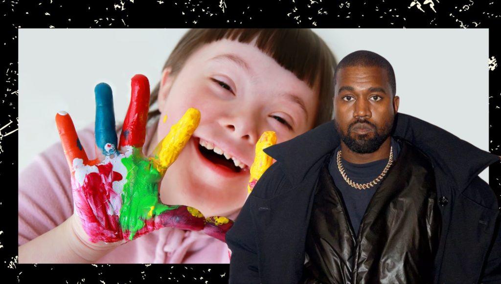 kanye west sindrome di down