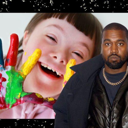 kanye west sindrome di down