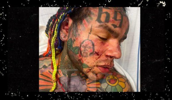 Aggredito brutalmente il rapper 6ix9ine in una sauna in Florida, è grave
